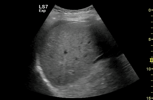 EEU case image missing